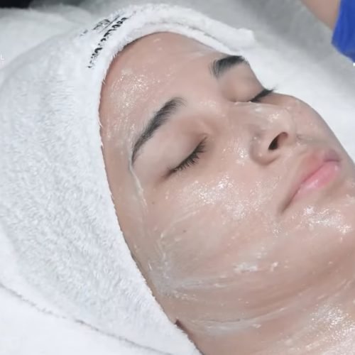 4: Se coloca la anestesia tópica (en crema) en el rostro completo y papada,